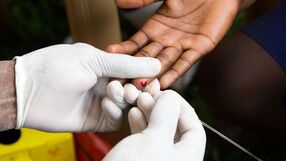 Shutterstock/Badanie na HIV