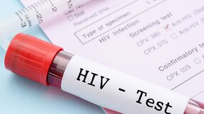 Badanie w kierunku HIV